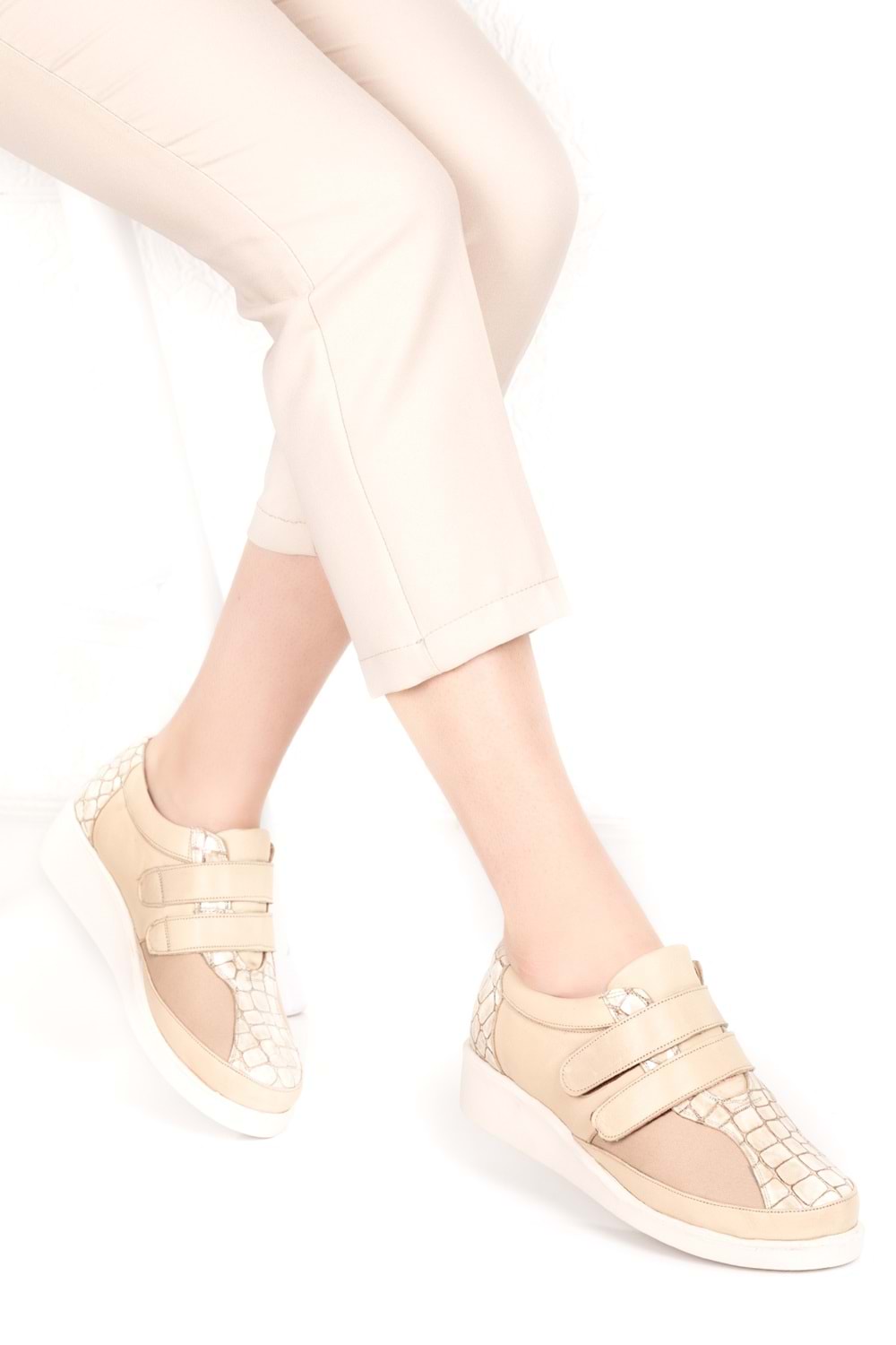 Gondol Hakiki Deri Kadın Kemik Çıkıntısına Özel Ayakkabı vdt.1670 - Bej - 35