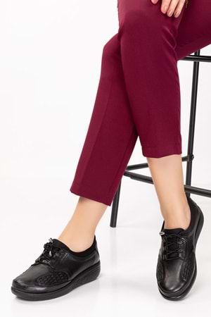 Gondol Hakiki Deri Kadın Kemik Çıkıntısına Özel Ayakkabı at.4204 - Siyah - 36