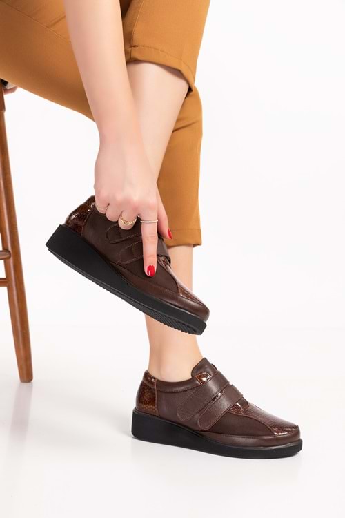 Gondol Hakiki Deri Kadın Kemik Çıkıntısına Özel Ayakkabı vdt.1670 - Kahverengi - 36