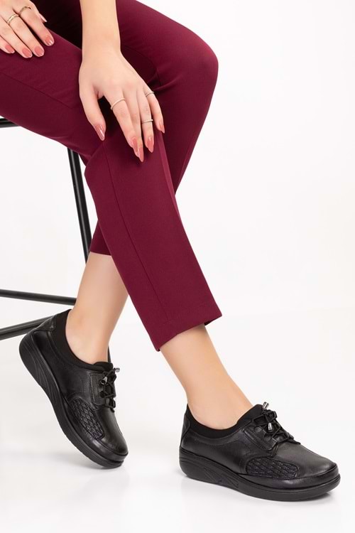 Gondol Hakiki Deri Kadın Kemik Çıkıntısına Özel Ayakkabı at.4204 - Siyah - 36