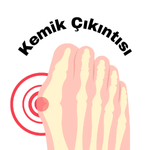 Kemik Çıkıntısı